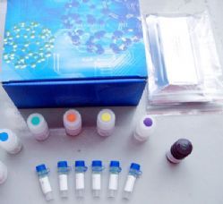人免疫球蛋白輕鏈lambda（λ-IgLC）ELISA Kit 產品說明與價格解析